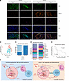 ZEB1 and CXCL16 are associated with chemotherapy resistance, immunosuppress