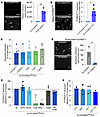 Essential role of mouse platelets in neutrophil adhesion to ICs.