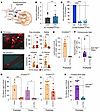 Platelets and neutrophils associate through PSGL-1 in inflammatory arthriti