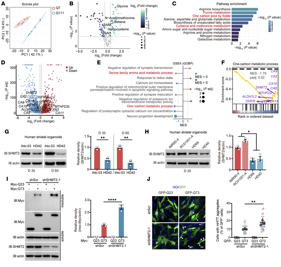 Multi-omics analysis reveals 1C metabolism dysregulation and reduced SHM...