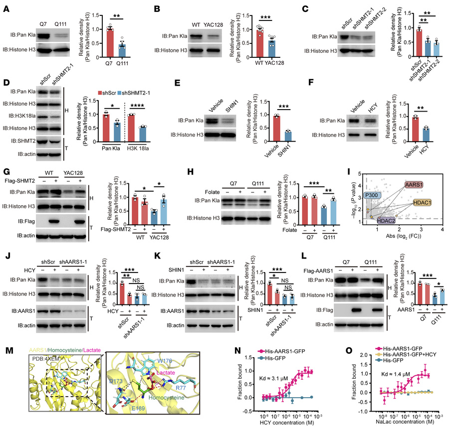 HCY suppresses histone lactylation through AARS1.
(A) Comparative immuno...