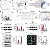 Multi-omics analysis reveals 1C metabolism dysregulation and reduced SHMT2