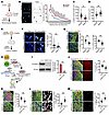 Loss of SHMT2 induces neuronal degeneration in iPSCs-derived hSOs.