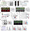SHMT2 overexpression ameliorates neurodegeneration both in vivo and in vitr