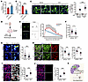SHMT2 deficiency drives neurodegeneration via HCY accumulation.