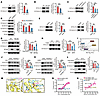 HCY suppresses histone lactylation through AARS1.