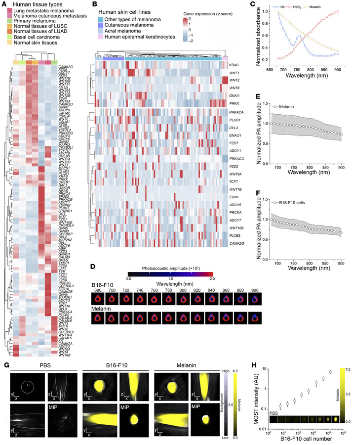 Dysregulated melanogenesis signaling in cutaneous melanoma and MLMs enab...