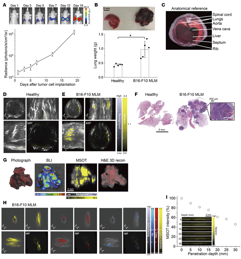 Macroscale tomographic detection of MLM lesions in living mice by MSOT.
...