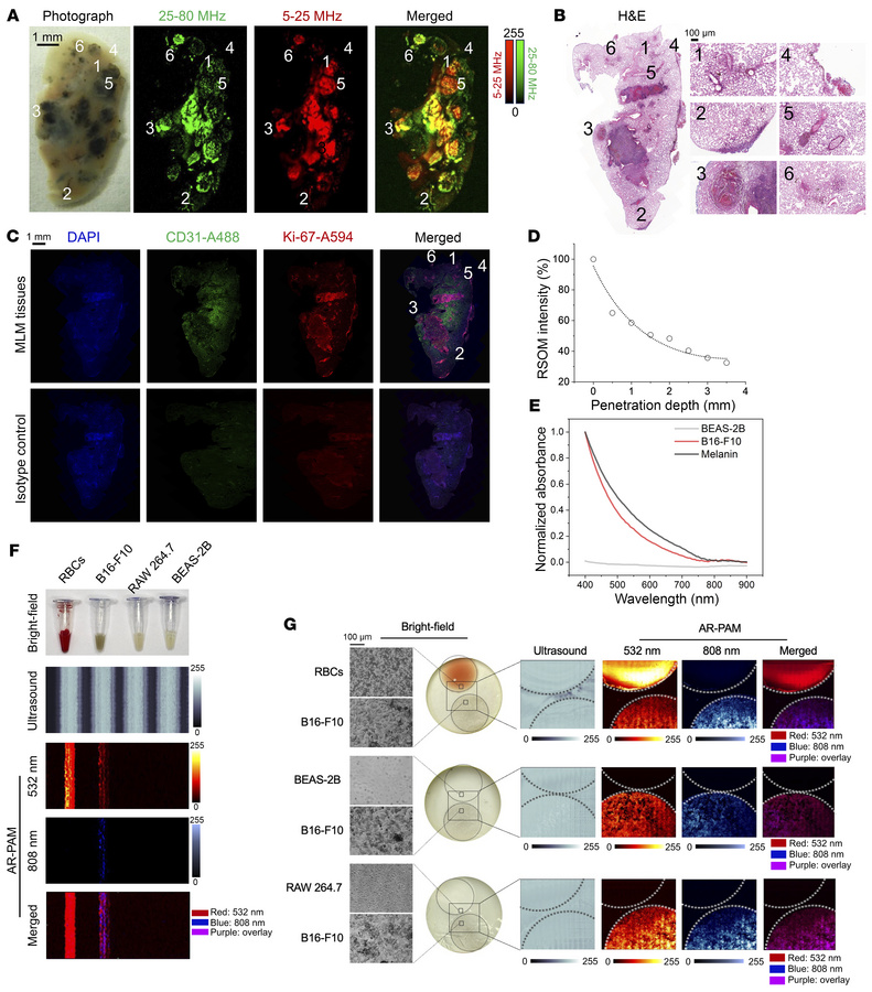 PAI of MLM at mesoscopic and microscopic scales by RSOM and AR-PAM.
(A) ...