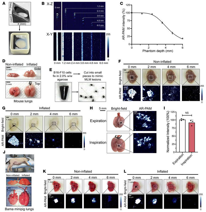 Intraoperative AR-PAM imaging of MLM lesions in inflated lungs of mice a...
