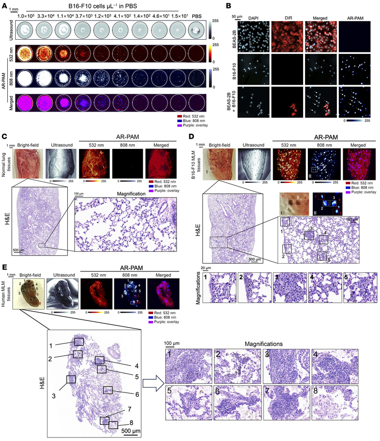 High-resolution AR-PAM imaging of pulmonary metastatic microlesions in M...