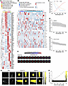 Dysregulated melanogenesis signaling in cutaneous melanoma and MLMs enables