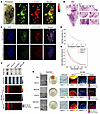 PAI of MLM at mesoscopic and microscopic scales by RSOM and AR-PAM.