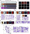 High-resolution AR-PAM imaging of pulmonary metastatic microlesions in MLM