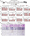 Evaluation of pulmonary functions by longitudinal WBP and histology after N