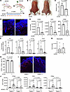 CCR3 antagonist reduces T cell numbers in skin and AD-related cytokine expr