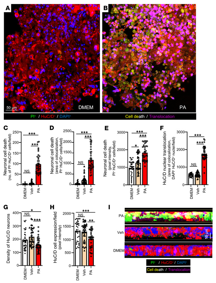 PA increases cell death in isolated nhMPG from colectomy surgical specim...