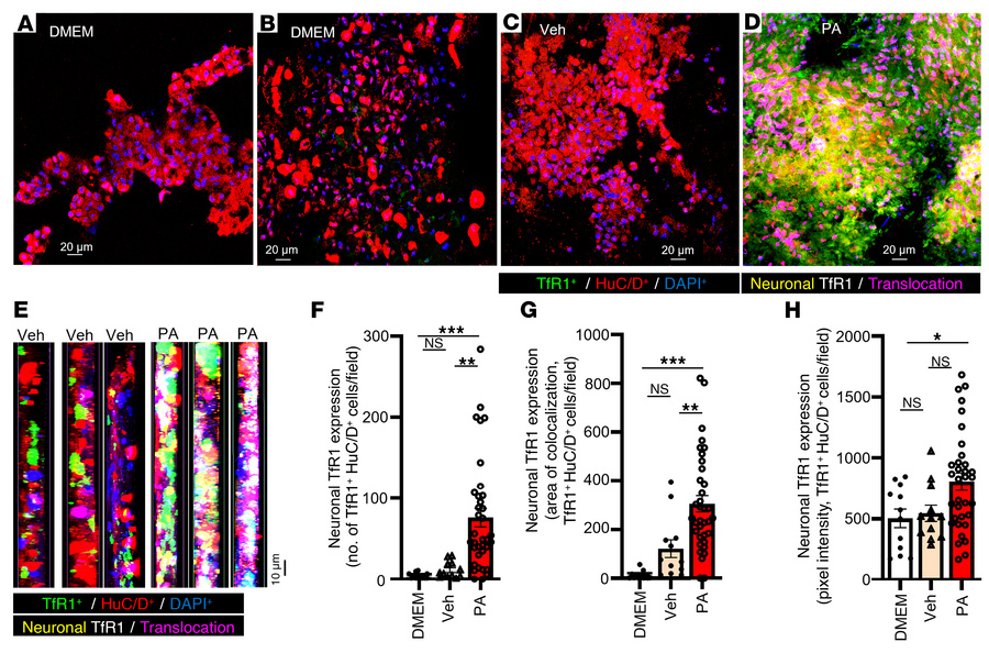PA induction of TfR1 expression in human myenteric neurons of nhMPG netw...