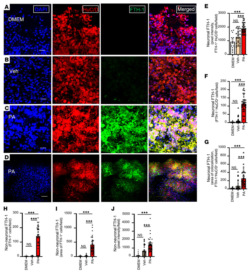 PA induction of FTH1 expression in human myenteric neurons of nhMPG netw...