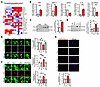 PA induces ferroptosis-associated iron accumulation in enteric neuronal cel