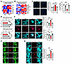 PA triggers ferroptotic stress and loss of enteric neuronal identity via li
