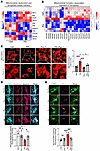 PA drives mitochondrial ferroptosis via ROS accumulation, mitochondrial dis