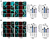 A WD increases transferrin receptor and ferritin levels in myenteric gangli