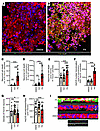 PA increases cell death in isolated nhMPG from colectomy surgical specimens