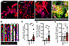 PA induction of TfR1 expression in human myenteric neurons of nhMPG network
