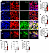 PA induction of FTH1 expression in human myenteric neurons of nhMPG network