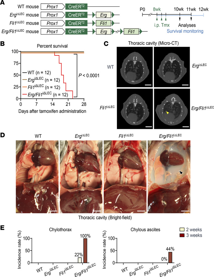 Both Erg and Fli1 are critical for maintaining thoracic duct valve integ...