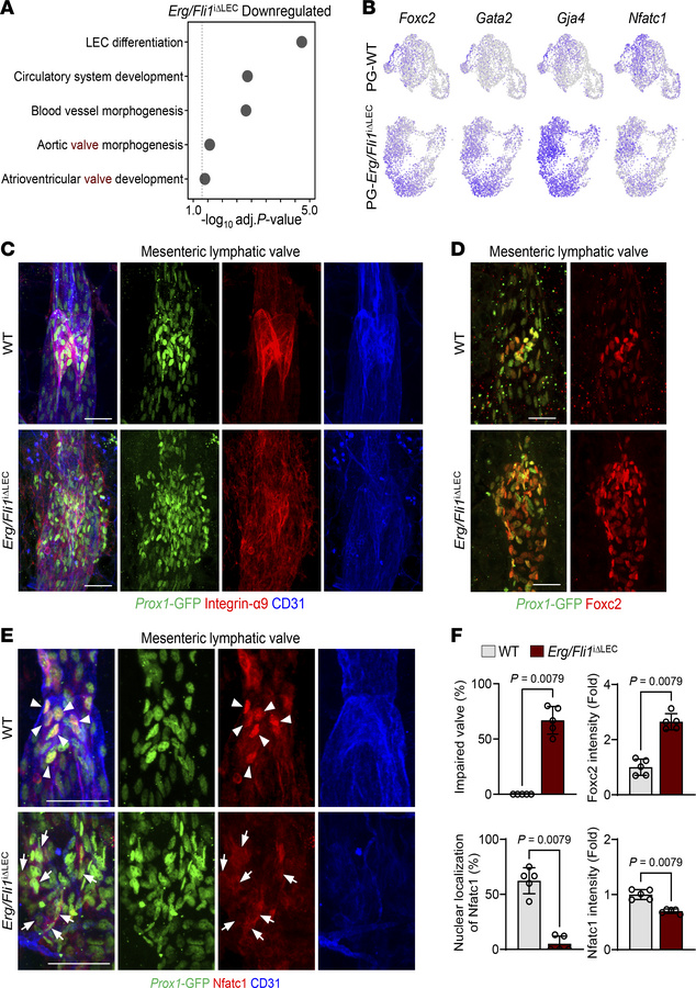 Dysregulation of lymphatic valve markers in Erg/Fli1iΔLEC mice.
(A–F) Di...