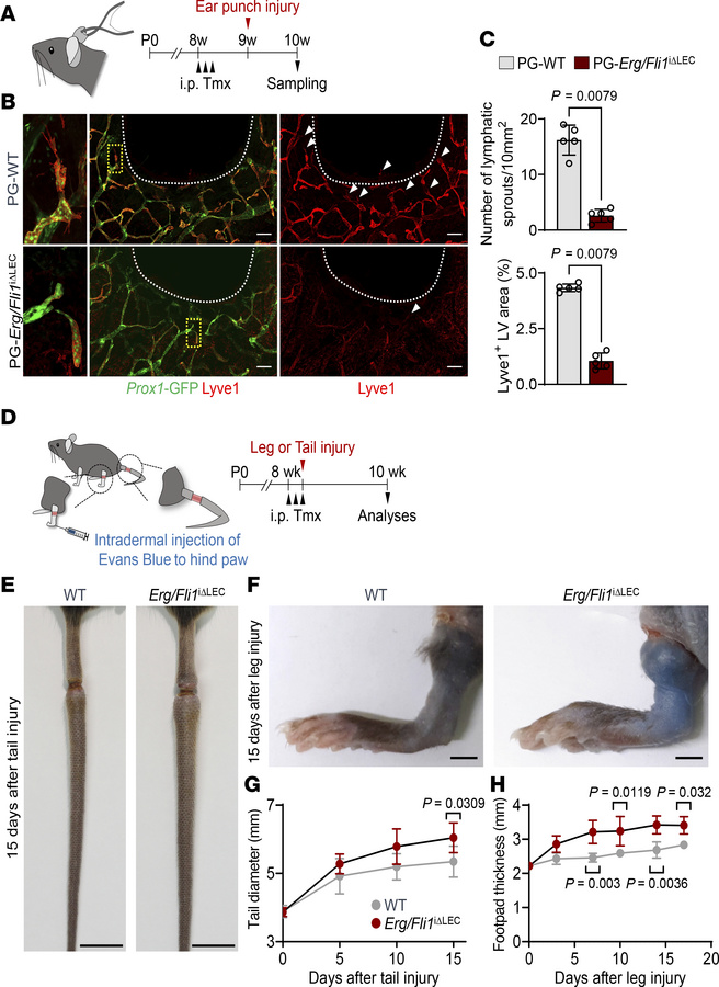 Dual deletion of Erg and Fli1 attenuates regenerative lymphangiogenesis....