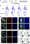 Lymphatic signature genes and proteins are downregulated in the lymphatics