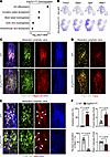Dysregulation of lymphatic valve markers in Erg/Fli1iΔLEC mice.