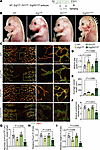 Erg and Fli1 are essential for lymphatic plexus patterning during embryonic