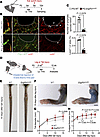 Dual deletion of Erg and Fli1 attenuates regenerative lymphangiogenesis.