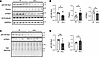 NALL leads to decreased pS129-syn but increased parkin in LRRK2R1441C mice.