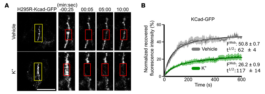 K+ increases AJ stability in NCI-H295R cells.
(A) Representative FRAP im...