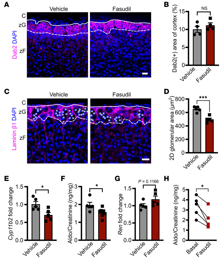 ROCK inhibition via fasudil decreases 2D glomerular area in the zG and b...