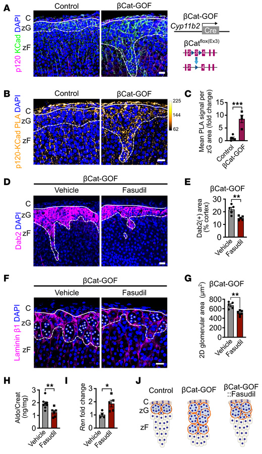 βCat stabilization strengthens AJs in the zG, while ROCK inhibition with...