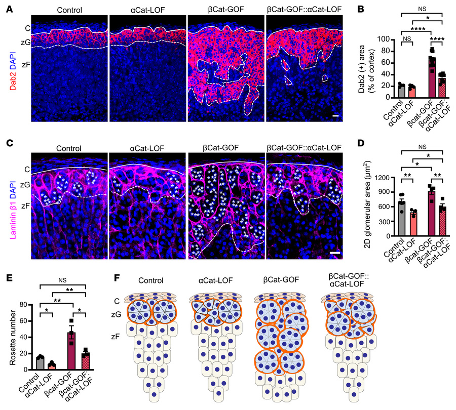 zG-specific αCat deletion attenuates βCat-GOF–induced zG hyperplasia and...