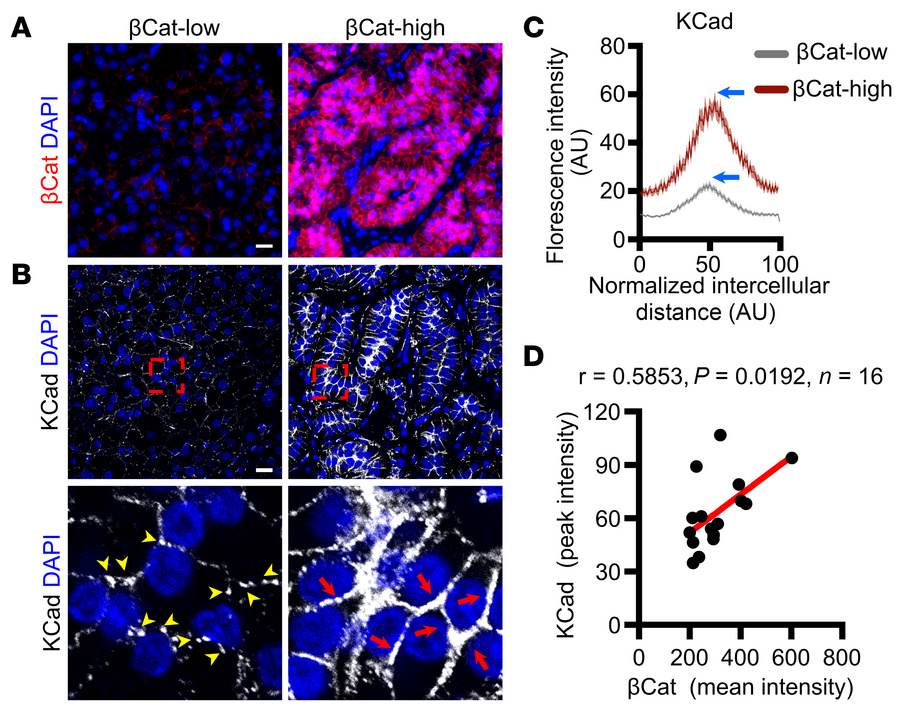 βCat expression positively correlates with KCad membrane localization in...