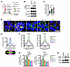 Aldosterone secretagogues increase AJ formation via the Rho/ROCK/NMII pathw