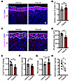 ROCK inhibition via fasudil decreases 2D glomerular area in the zG and blun