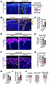 βCat stabilization strengthens AJs in the zG, while ROCK inhibition with fa