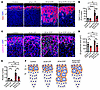 zG-specific αCat deletion attenuates βCat-GOF–induced zG hyperplasia and ro