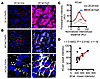 βCat expression positively correlates with KCad membrane localization in hu