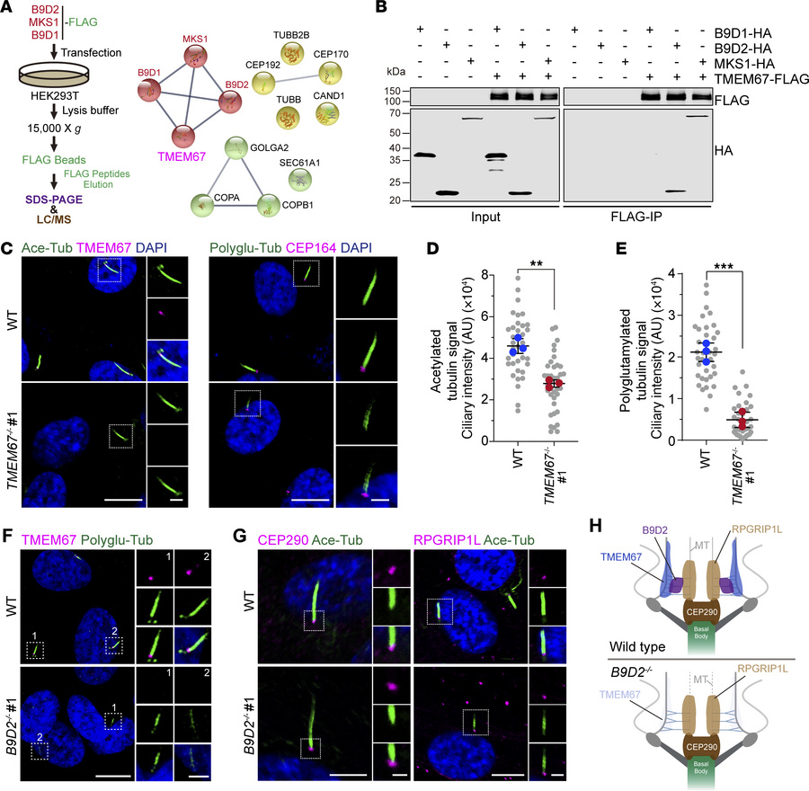 The B9 complex anchors TMEM67 at the TZ to maintain the modifications of...