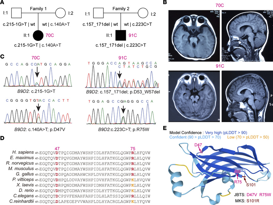 Variants in B9D2 are associated with JBTS.
(A) Pedigrees of families wit...